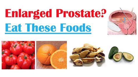Best Foods To Eat With Enlarged Prostate Reduce Risk Of Symptoms Enlargement Cancer
