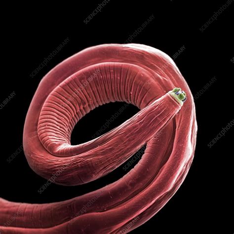 Parasitic Roundworm Sem Stock Image C0370819 Science Photo Library