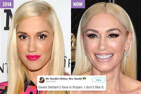 Gwen Stefani 50 Accused Of Getting Plastic Surgery As She Looks ‘frozen And ‘unrecognizable