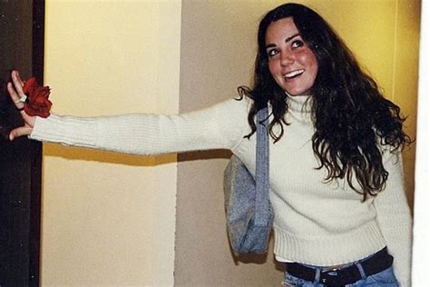 Kate Middleton Before And After Plastic Surgery Face Body
