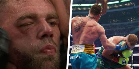 Doctor Discusses Whether Billy Joe Saunders Was Right To Quit Against