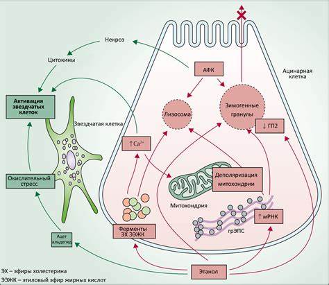 Острый панкреатит Картинка - Острый панкреатит