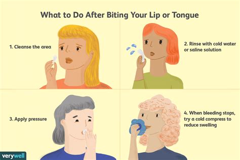 What To Do When You Bite Your Lip Or Tongue