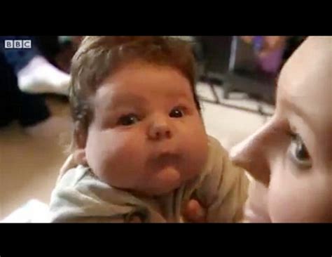 Woman Gives Birth To 15 Pound Baby Picture Medical Marvels Abc News