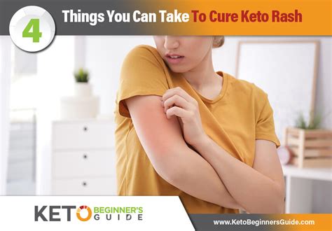 Keto Beginners Guide 4 Things You Can Take To Cure Keto Rash