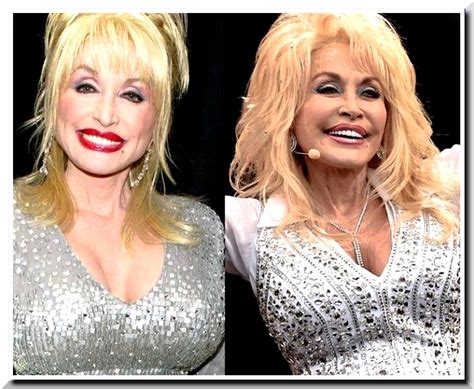 Dolly Parton Has Done Plastic Surgery To Almost All Her Body Parts Macadamian Paradise Blog