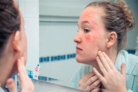 10 Common Skin Rashes How To Treat Them Helthy Favor Today