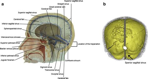 Illustration Of The Sagittal Sinus A Head Anatomy Along The Sagittal