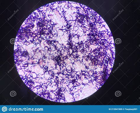 Bacillus Gram Positive Stain Under Microscope View Bacillus Is Rod