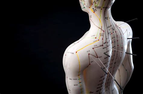 dry needling what is dry needling and it s benefits avaana