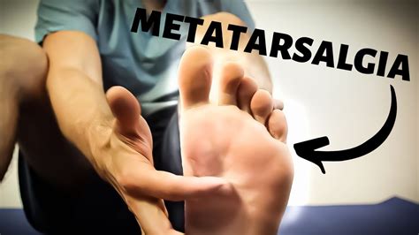 Pain In Sole Of Foot Near Toes Treatment Guide