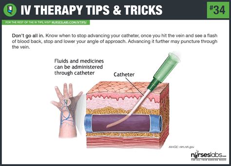 55 IV Therapy Tips and Tricks for Intravenous Nurses: The ...