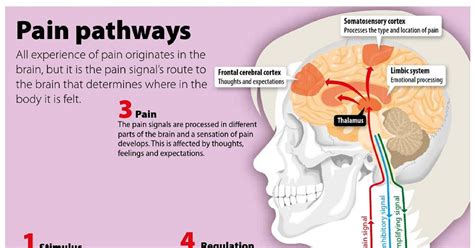 Infographic Pain Pathways