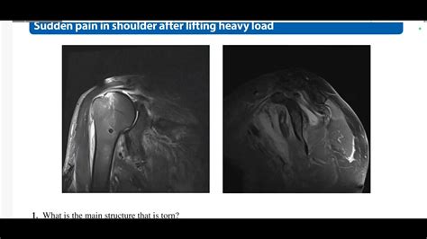 Msk Mc Graw Hill Radiology Case Review Series Youtube