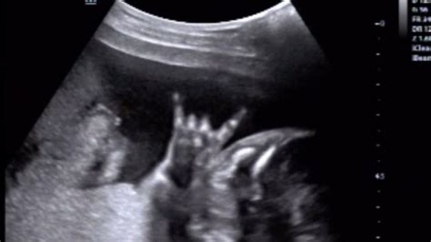 Rock On This Babys Sonogram Looks Like Hes Ready For A Music Career
