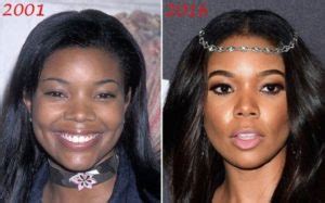 Gabrielle Union Before And After Plastic Surgery Nose Job