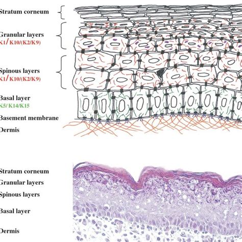 Expression Patterns Of Keratins And Keratin Disorders Download Table