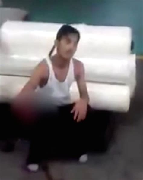 Gruesome Video Shows Man S Severed Arm After His Hand Is Chopped Off In Accident At Work World