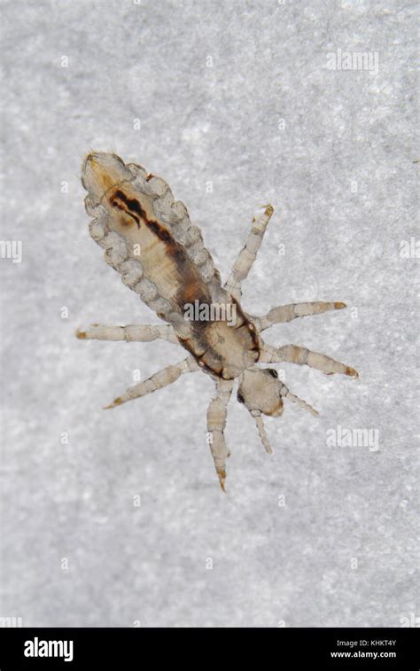 Head Louse Head Lice Stock Photo Alamy