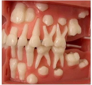 Diş Hekimi Ayşe Naime (Kor) Altuntaş | Çocuk Dişleri