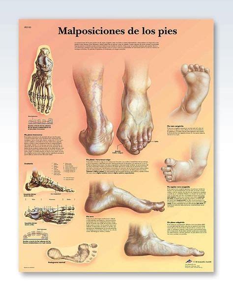 This Spanish Language 20x26 Inch Anatomical Poster Displays Gross Anatomy Of Human Foot