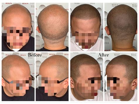 點藝頭皮美學 Scalp Aesthetics Taiwan - 小平頭作品集
