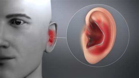 cure ear infection in one day health gadgetsng