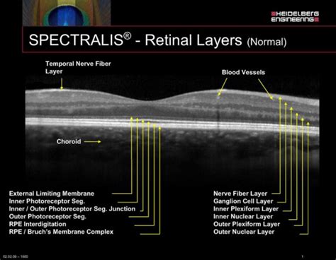 Optical Coherence Tomography Eyewiki