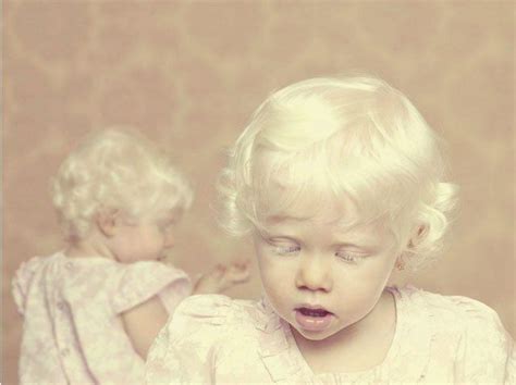 Albinos A Beautiful Photo Essay Of People With Albinism Albinism