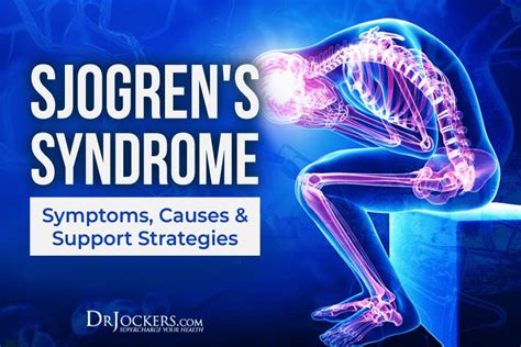 Sjogrens Syndrome Symptoms Causes And Natural Support Strategies