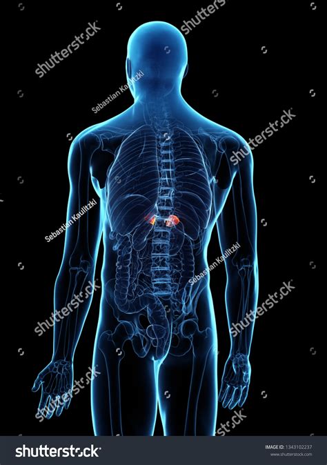 3d Rendered Medically Accurate Illustration Diseased Stock Illustration