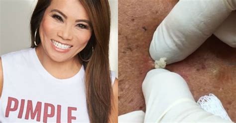 Behold Dr Pimple Popper Skincare Is Now A Thing