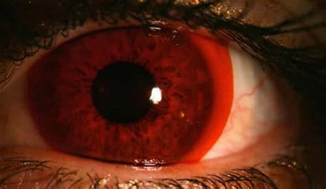 10 Insanely Weird Contact Lenses