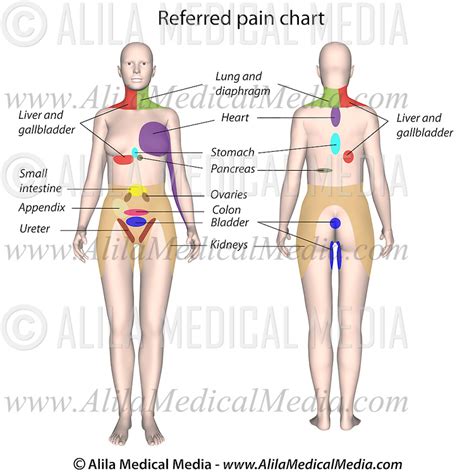 Organ Referred Pain Chart Alila Medical Images
