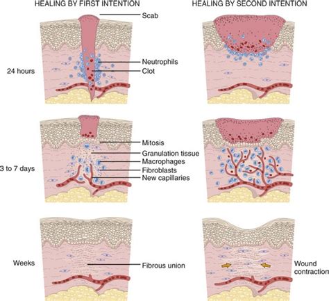 Mechanisms Of Wound Repair Wound Healing And Wound Dr