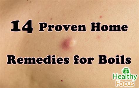 14 Proven Home Remedies For Boils Healthy Focus