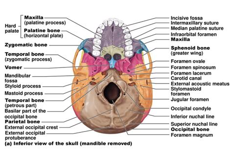 Case 20 Anatomy Of The Skull Diagram Quizlet