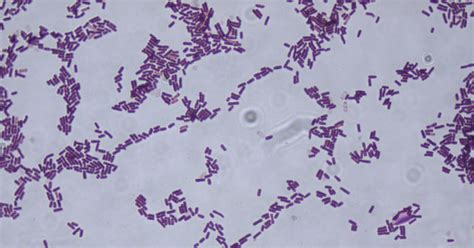 Mcqs On Gram Positive Spore Forming Bacilli Medical Microbiology
