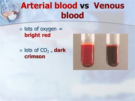 Human Blood Color Deoxygenated Blood Vs Oxygenated Blood Different