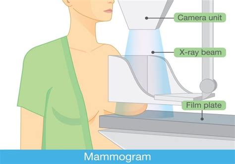 Mammogram Everything You Need To Know About Mammograms Left Side Pains