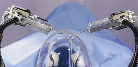 Robotic Cataract Surgery Procedure Working And Benefits Of It