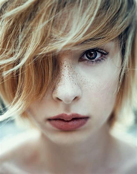 98 Freckled People Wholl Hypnotize You With Their Unique