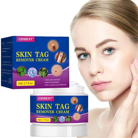 Buy Skin Tag Removal Cream, Warts & Mole Remover Cream, Skin Tag