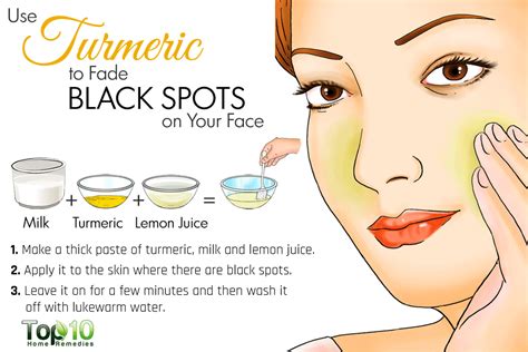 Home Remedies For Black Spots On Your Face Health Nigeria