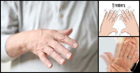 Common Causes Of Hand Tremors Shaky Hands Dr Farrah Md