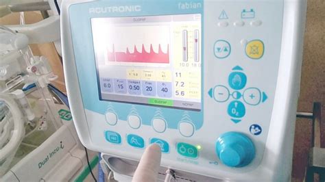 Hospital Clínico Realizó Curso De Ventilación Neonatal Elpinguinocom