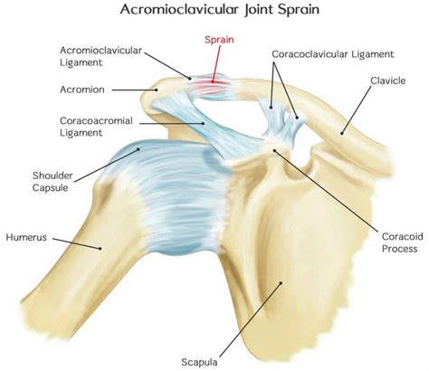 Acromioclavicular Joint Acromioclavicular Joint Injury Separation