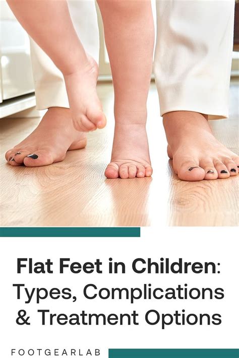 Flat Feet In Children Types Complications And Treatment Options Artofit