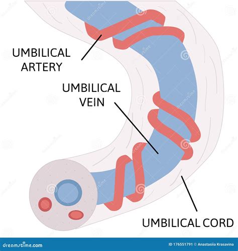 Anatomie Du Cordon Ombilical Deux Artères Ombilicales Et Un Cordon