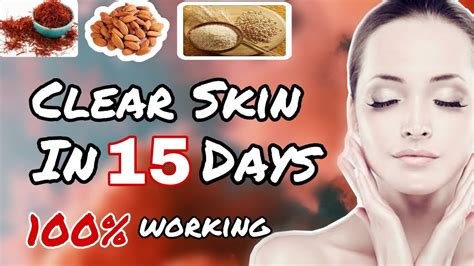 Get Clear Skin In 15 Days Skin Whitening Home Remedy Sanas Style